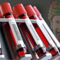 rajkotupdates.news:emm-negative-rare-blood-group-found-in-rajkot-man-11th-such-case-worldwide
