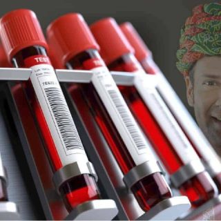 rajkotupdates.news:emm-negative-rare-blood-group-found-in-rajkot-man-11th-such-case-worldwide
