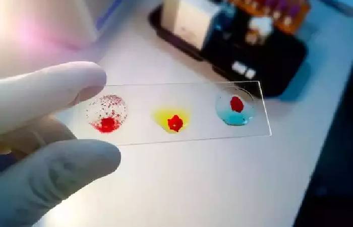 rajkotupdates.news:emm-negative-rare-blood-group-found-in-rajkot-man-11th-such-case-worldwide